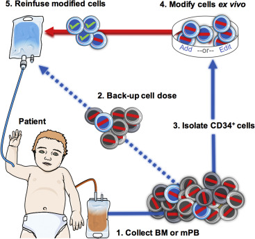 Hematopoietic Stem Cell Gene Therapy Progress And Lessons Learned