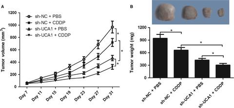 LncRNA UCA1 Promotes Proliferation And Cisplatin Resistance Of Oral