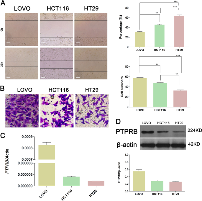 Ptprb Promotes Metastasis Of Colorectal Carcinoma Via Inducing