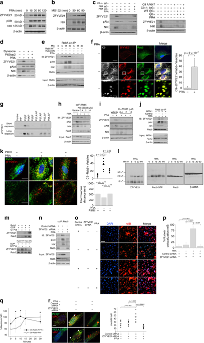 ZFYVE21 Is A Complement Induced Rab5 Effector That Activates Non