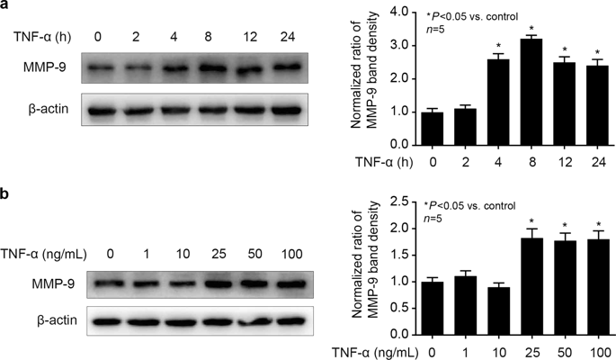 Propofol Attenuates Tnf Induced Mmp Expression In Human Cerebral