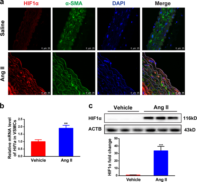 Hypoxia Inducible Factor In Vascular Smooth Muscle Cells Promotes