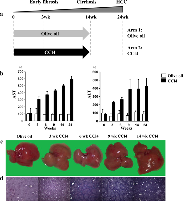 Metformin Prevents Liver Tumourigenesis By Attenuating Fibrosis In A