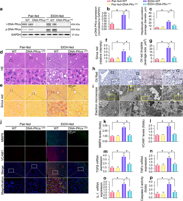 Dna Pkcs Promotes Alcohol Related Liver Disease By Activating Drp