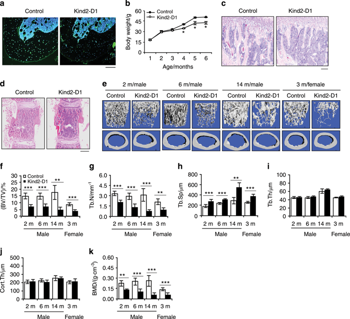 Focal Adhesion Protein Kindlin Regulates Bone Homeostasis In Mice