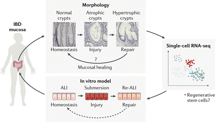 A New Model Of Intestinal Epithelial Regeneration Could Patients