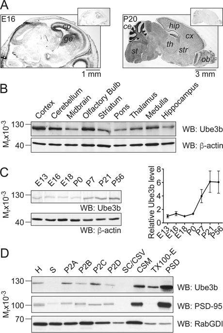 The Murine Ortholog Of Kaufman Oculocerebrofacial Syndrome Protein