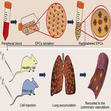 Evidence Of Accumulated Endothelial Progenitor Cells In The Lungs Of