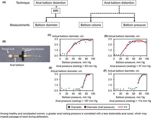 A New Method For Assessing Anal Distensibility With A Barostat And