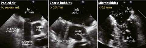 Investigation Of Air Bubble Properties Relevance To Prevention Of