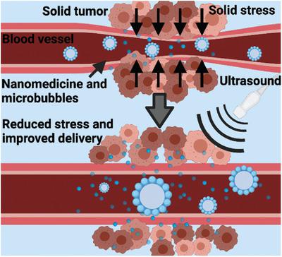 Sonopermeation With Nanoparticle Stabilized Microbubbles Reduces Solid