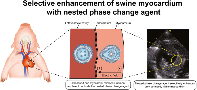 Selective Enhancement Of Swine Myocardium With A Novel Ultrasound