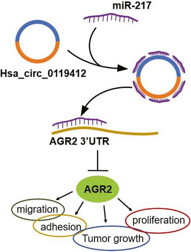 Hsa Circ Overexpression Promotes Cervical Cancer Progression By