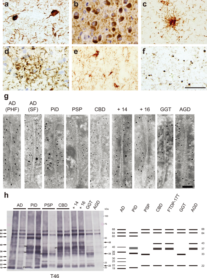 Tau Tdp Acta Neuropathologica X Mol