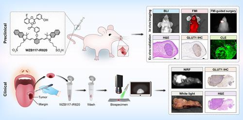 Glut International Journal Of Cancer