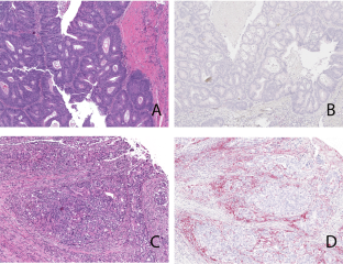 Modern Pathology X Mol