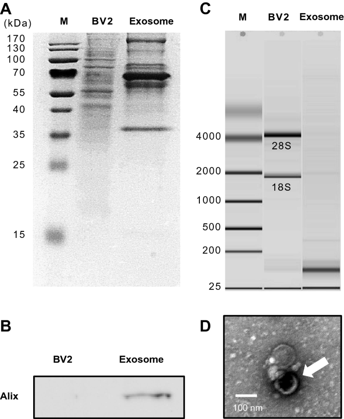 Exosomal Mirna From Toxoplasma Gondii Infected Microglial Cells