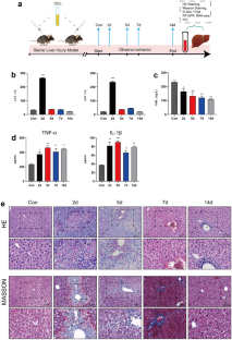 S100A6 Activates Kupffer Cells Via The P P38 And P JNK Pathways To