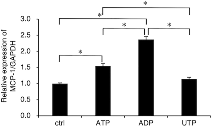 Extracellular adenosine 5ʹ diphosphate promotes MCP 1 CCL2 expression