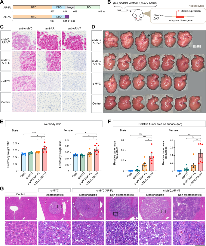 Androgen Receptor Variant 7 Exacerbates Hepatocarcinogenesis In A C MYC