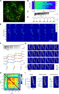 Conserved Spatiotemporal Dynamics With Millisecond Precision During