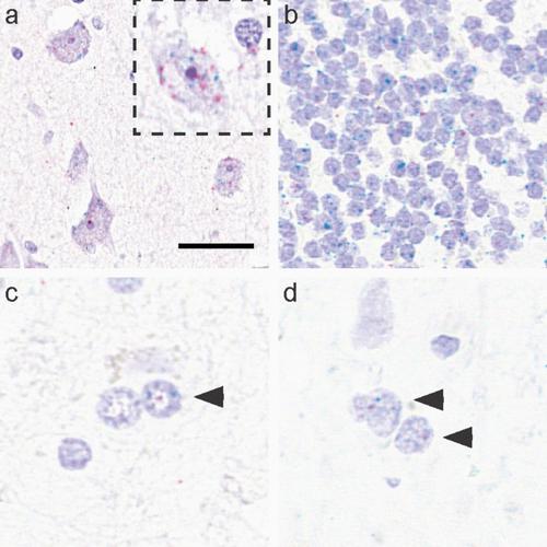 Cell Specific Mapt Gene Expression Is Preserved In Neuronal And Glial