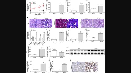 LncRNA SNHG1 Knockdown Inhibits Hyperglycemia Induced Ferroptosis Via