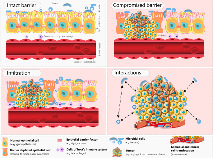 Environmental Insults And Compensative Responses When Microbiome Meets