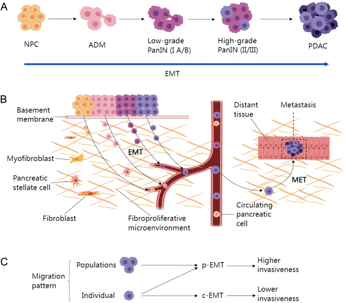 The Role Of Epithelial Mesenchymal Transition And Autophagy In