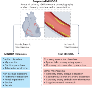 Sex Specific And Ethnicity Specific Differences In MINOCA Nature