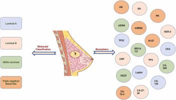 乳腺癌的潜在诊断和预后生物标志物综述 Pathology Research and Practice X MOL