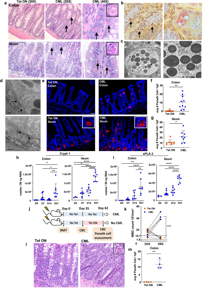 Interleukin Production By Type Innate Lymphoid Cells Induces Paneth