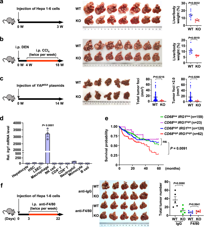 Itaconate Promotes Hepatocellular Carcinoma Progression By Epigenetic