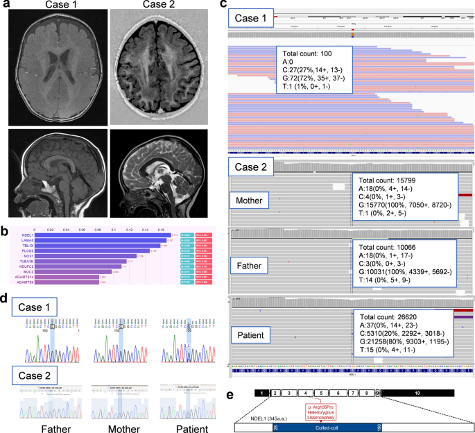 Novel Lissencephaly Associated Ndel Variant Reveals Distinct Roles Of