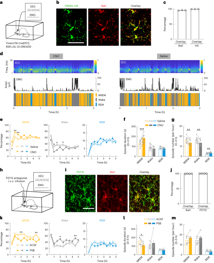 Microglia Regulate Sleep Through Calcium Dependent Modulation Of