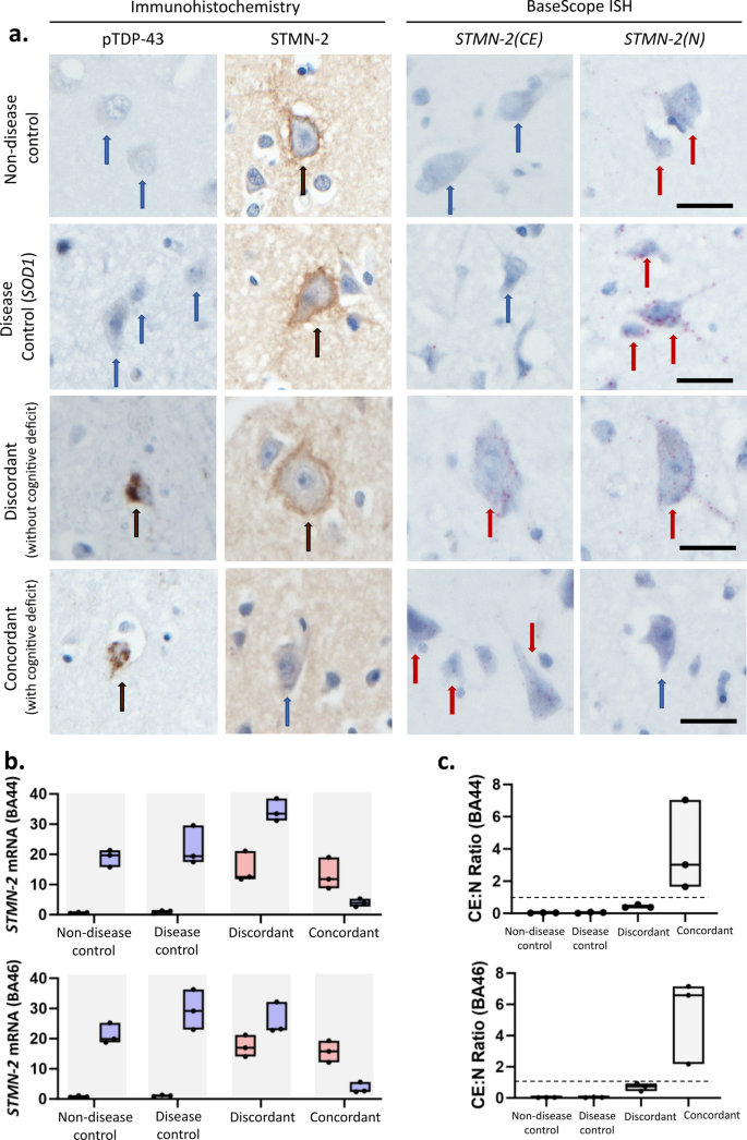 Rna Aptamer Reveals Nuclear Tdp Pathology Is An Early Aggregation