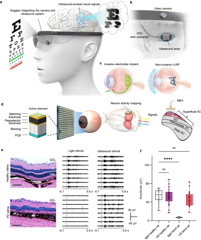 Noninvasive Imaging Guided Ultrasonic Neurostimulation With Arbitrary