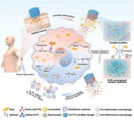 Immunometabolic Checkpoint Mediated Macrophage Metabolic Reprogramming