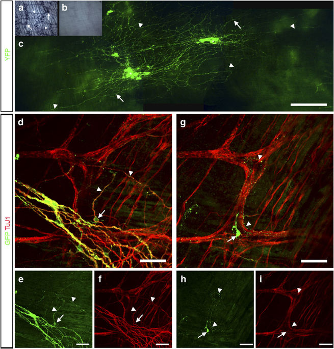 Transplantation of enteric nervous system stem cells rescues nitric