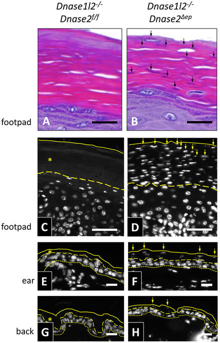 Cornification Inactivation of DNase1L2 and DNase2 in keratinocytes suppresses DNA ...