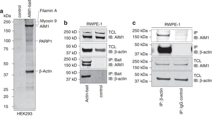 AIM1是一种肌动蛋白结合蛋白，可抑制细胞迁移和微转移。,Nature Communications - X-MOL