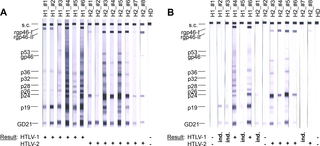 No Significant Htlv Seroprevalence In German People Who Inject Drugs Plos One X Mol