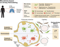 Airway Microbiota Signals Anabolic And Catabolic Remodeling In The Transplanted Lung Journal Of Allergy And Clinical Immunology X Mol