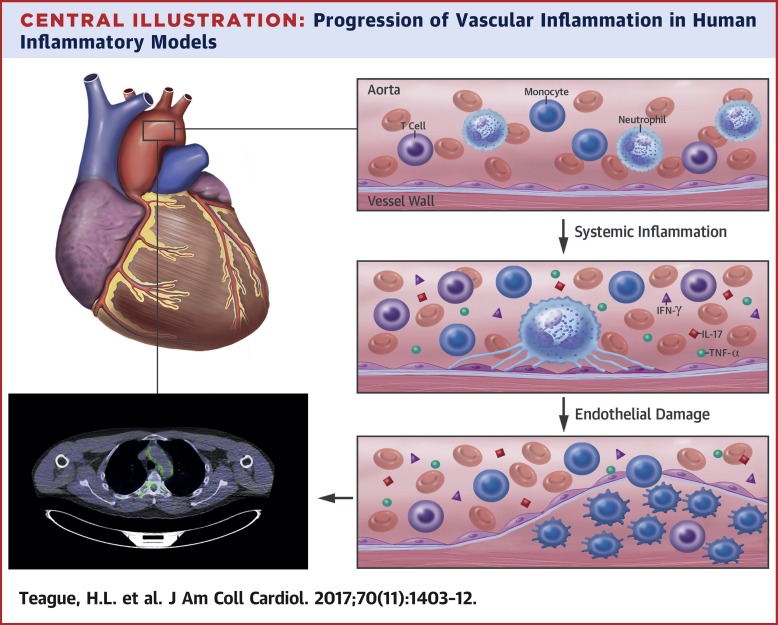 解开血管炎症,Journal of the American College of Cardiology - X-MOL
