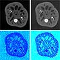Coded aperture optimization in compressive X-ray tomography: a gradient ...