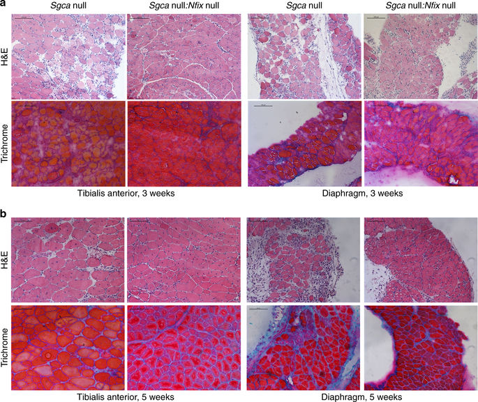 Nfix Mutation Silencing Nfix rescues muscular dystrophy by delaying muscle ...