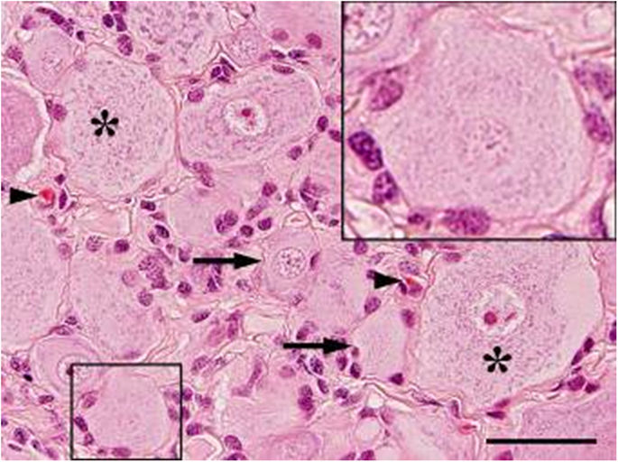 satellite glial cells