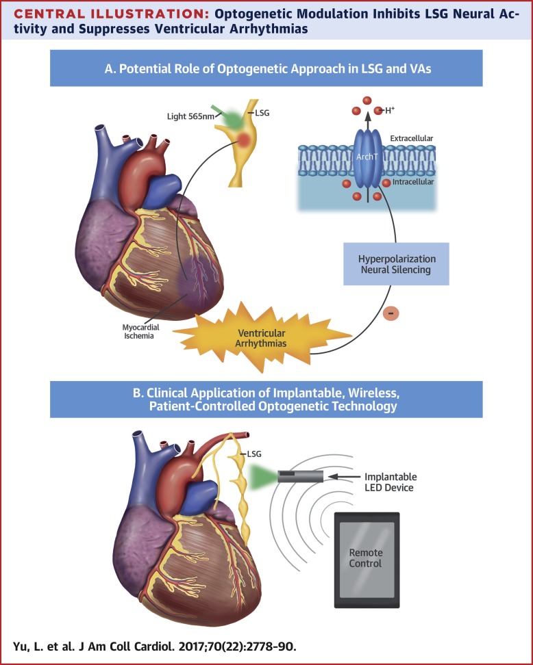 optogenetic-modulation-of-cardiac-sympathetic-nerve-activity-to-prevent