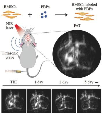 In Vivo Photoacoustic Imaging of Brain Injury and Rehabilitation by ...