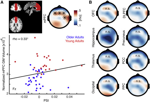 Old Brains Come Uncoupled in Sleep: Slow Wave-Spindle Synchrony 